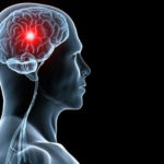 Tratamentul care poate diminua leziunile creireului cauzate de accidentul vascular cerebral