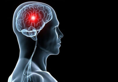 Tratamentul care poate diminua leziunile creireului cauzate de accidentul vascular cerebral