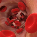 Medicamentul care poate salva viața pacienților care suferă de sepsis