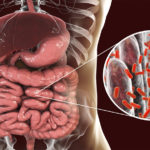 Legătura dintre stres și apariția bolilor autoimune