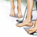 Medicamentul experimental care tratează cea mai rară boală musculară genetică