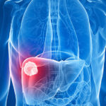 Metoda care poate ajuta la menținerea funcției ficatului