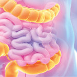 Terapia neconvențională pentru tratarea cancerului rectal